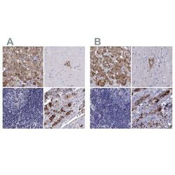 Chromogranin C Antibody, Novus Biologicals 25ul; Unconjugated:Antibodies,