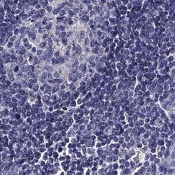 Chromogranin C Antibody, Novus Biologicals 25ul; Unconjugated:Antibodies,