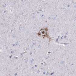 Chromogranin C Antibody, Novus Biologicals 25ul; Unconjugated:Antibodies,