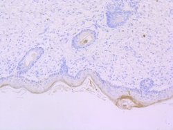 Chymase/CMA1/Mast Cell Chymase Rabbit anti-Human, Mouse, Rat, Clone: JB74-32,