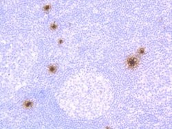 Chymase/CMA1/Mast Cell Chymase Rabbit anti-Human, Mouse, Rat, Clone: JB74-32,