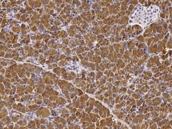 Chymotrypsin C/CTRC Antibody, Novus Biologicals:Antibodies:Primary Antibodies