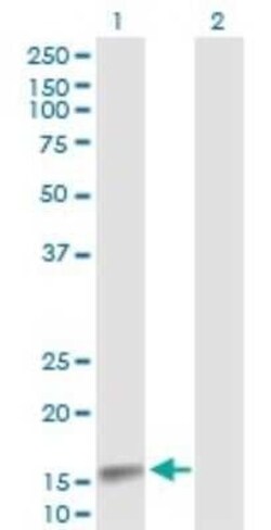 Citidine Deaminase Antibody, Novus Biologicals 50 &mu;g | Buy Online | Novus Biologicals | Fisher Scientific