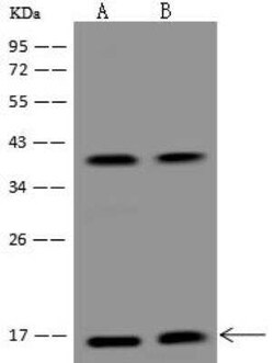 Citidine Deaminase Antibody, Novus Biologicals:Antibodies:Primary Antibodies