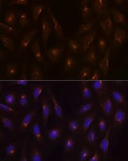 Clathrin Heavy Chain 1/CHC17 Rabbit anti-Human, Mouse, Rat, Clone: 9M2G2, Novus Biologicals 20 &mu;g | Buy Online | Bio-Techne | Fisher Scientific