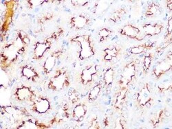 Clathrin Heavy Chain 1/CHC17 Rabbit anti-Human, Mouse, Rat, Clone: 9M2G2, Novus Biologicals 20 &mu;g | Buy Online | Bio-Techne | Fisher Scientific