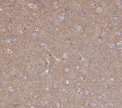Clathrin Heavy Chain 1/CHC17 Antibody, Novus Biologicals 25 &mu;L | Buy Online | Novus Biologicals | Fisher Scientific