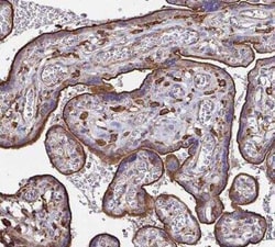 Clathrin Heavy Chain 1/CHC17 Antibody, Novus Biologicals 25 &mu;L | Buy Online | Novus Biologicals | Fisher Scientific