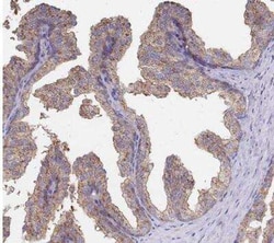 Clathrin Heavy Chain 1/CHC17 Antibody, Novus Biologicals 25 &mu;L | Buy Online | Novus Biologicals | Fisher Scientific