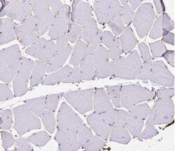 Clathrin Heavy Chain 1/CHC17 Antibody, Novus Biologicals 25 &mu;L | Buy Online | Novus Biologicals | Fisher Scientific