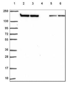 Clathrin Heavy Chain 1/CHC17 Antibody, Novus Biologicals 25 &mu;L | Buy Online | Novus Biologicals | Fisher Scientific