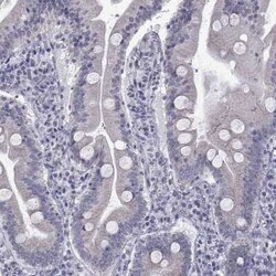 Clathrin Heavy Chain 2/CHC22/CLTCL1 Rabbit anti-Human, Polyclonal, Novus