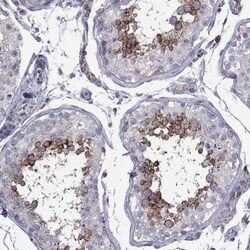 Clathrin Heavy Chain 2/CHC22/CLTCL1 Rabbit anti-Human, Polyclonal, Novus