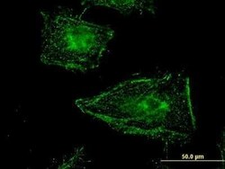 Clathrin interactor 1 Antibody (1E6), Novus Biologicals 0.1 mg | Buy Online | Novus Biologicals | Fisher Scientific