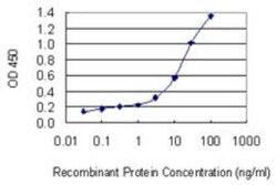 Clathrin light chain Antibody (4E9), Novus Biologicals 0.1 mg | Buy Online | Novus Biologicals | Fisher Scientific