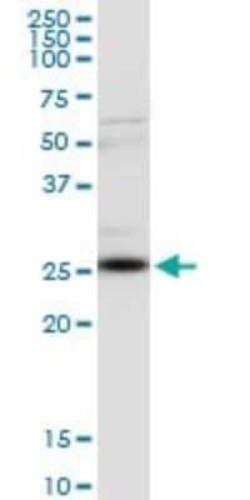 Clathrin light chain Antibody (4E9), Novus Biologicals 0.1 mg | Buy Online | Novus Biologicals | Fisher Scientific