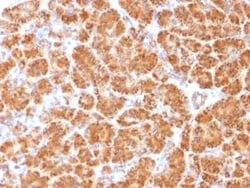 Clathrin light chain Antibody (CLC/1421), Novus Biologicals:Antibodies:Primary