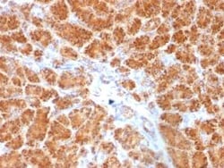 Clathrin light chain Antibody (SPM174), Novus Biologicals 20&mu;g; Unlabeled:Antibodies,