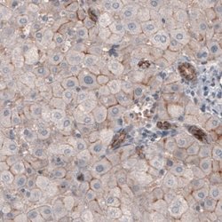 Claudin-1 Antibody (CL3698), Novus Biologicals 100&mu;L:Antibodies, Monoclonal