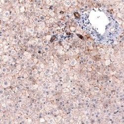 Claudin-1 Antibody (CL3698), Novus Biologicals 100&mu;L:Antibodies, Monoclonal