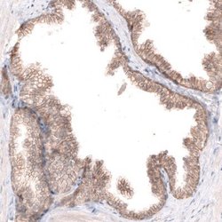 Claudin-1 Antibody (CL3698), Novus Biologicals 100&mu;L:Antibodies, Monoclonal