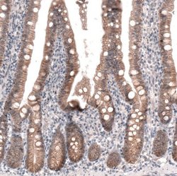 Claudin-1 Antibody (CL3698), Novus Biologicals 100&mu;L:Antibodies, Monoclonal