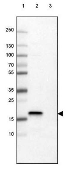 Claudin-1 Antibody (CL3698), Novus Biologicals 100&mu;L:Antibodies, Monoclonal