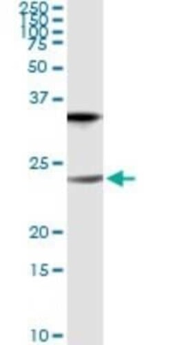 Claudin-1 Antibody (1C5-D9), Novus Biologicals 0.1 mg | Buy Online | Novus Biologicals | Fisher Scientific