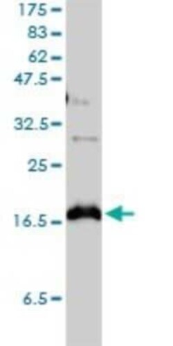 Claudin-1 Antibody (1C5-D9), Novus Biologicals 0.1 mg | Buy Online | Novus Biologicals | Fisher Scientific