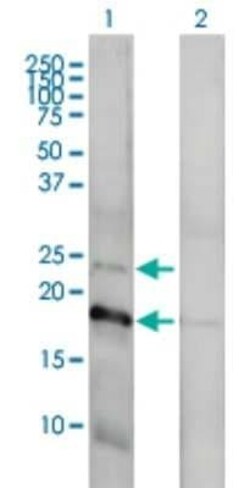 Claudin-1 Antibody (1C5-D9), Novus Biologicals 0.1 mg | Buy Online | Novus Biologicals | Fisher Scientific