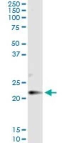 Claudin-14 Antibody (3D11), Novus Biologicals 0.1 mg | Buy Online | Novus Biologicals | Fisher Scientific