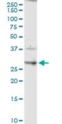 Claudin-14 Antibody, Novus Biologicals 0.1 mg | Buy Online | Novus Biologicals | Fisher Scientific