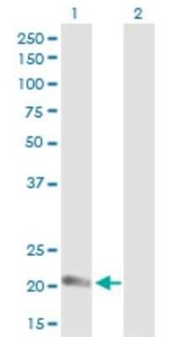 Claudin-14 Antibody, Novus Biologicals 0.1 mg | Buy Online | Novus Biologicals | Fisher Scientific