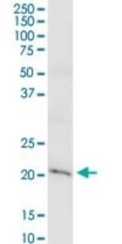 Claudin-15 Antibody, Novus Biologicals 0.1 mg | Buy Online | Novus Biologicals | Fisher Scientific