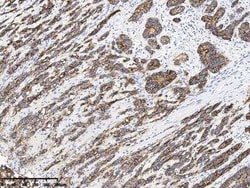Claudin-18 Mouse anti-Human, Clone: 2, Novus Biologicals 100 &mu;g; Unconjugated:Antibodies,