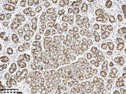 Claudin-18 Rabbit anti-Human, Clone: 179, Novus Biologicals 100 &mu;g;