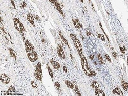 Claudin-18 Rabbit anti-Human, Clone: 179, Novus Biologicals 100 &mu;g;