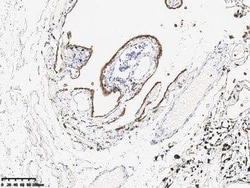 Claudin-18 Rabbit anti-Human, Clone: 179, Novus Biologicals 100 &mu;g;