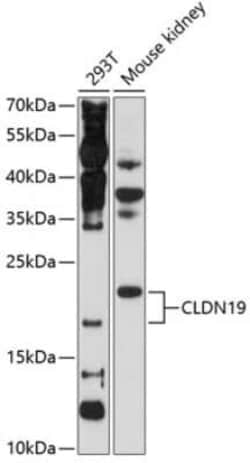 Claudin-19 Antibody - BSA Free, Novus Biologicals:Antibodies:Primary Antibodies