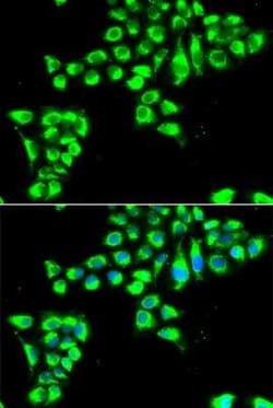Claudin-2 Antibody - BSA Free, Novus Biologicals™