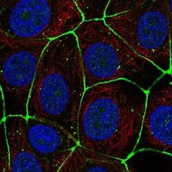 Claudin-3 Antibody, Novus Biologicals 25 &mu;L, Unconjugated:Antibodies,