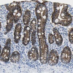 Claudin-3 Antibody, Novus Biologicals 25 &mu;L, Unconjugated:Antibodies,