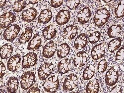 Claudin-7 Antibody, Novus Biologicals:Anticuerpos:Anticuerpos primarios