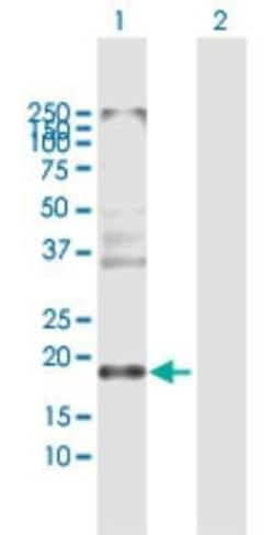 Claudin-8 Antibody, Novus Biologicals 0.05 mg | Buy Online | Novus Biologicals | Fisher Scientific