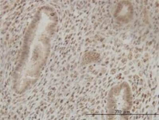 Cleavage stimulation factor 2 Antibody (3D13A6), Novus Biologicals™ 0.