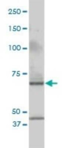 Cleavage stimulation factor 2 Antibody (3D1-3A6), Novus Biologicals 0.1 mg | Buy Online | Novus Biologicals | Fisher Scientific