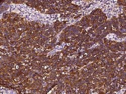 Clusterin/APOJ Rabbit anti-Human, Clone: 210, Novus Biologicals 50 &mu;g;
