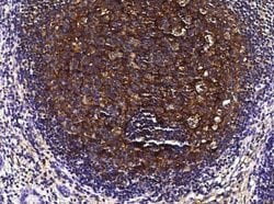 Clusterin/APOJ Rabbit anti-Human, Clone: 210, Novus Biologicals 50 &mu;g;