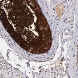 Clusterin/APOJ Antibody, Novus Biologicals 25 &mu;L | Buy Online | Novus Biologicals | Fisher Scientific