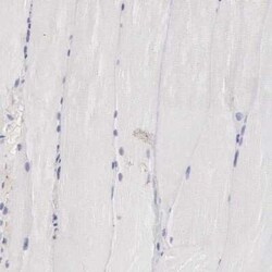 Clusterin/APOJ Antibody, Novus Biologicals 25 &mu;L | Buy Online | Novus Biologicals | Fisher Scientific